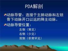 动脉导管未闭(pda