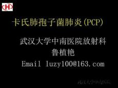 卡氏肺孢子菌肺炎