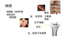 骨关节结核
