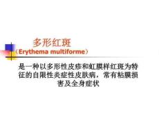 红斑鳞屑性皮肤病m
