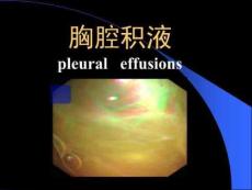 结核性胸膜炎课件