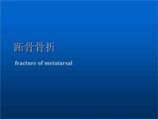 跖骨骨折ppt课件