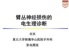臂丛神经损伤的诊治进展
