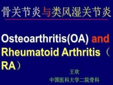 骨关节炎与类风湿关节炎