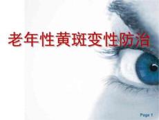 老年性黄斑变性防治