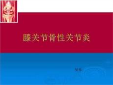 膝关节骨性关节炎