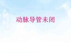 《动脉导管未闭》PPT课件