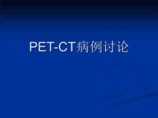 《气管腺样囊性癌》PPT课件