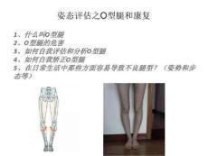 姿态评估之o型腿与康复课件