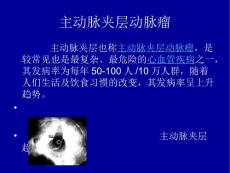 主动脉夹层动脉瘤 （3）