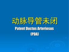 动脉导管未闭和房间隔缺损儿科学精品课件