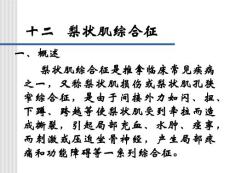 梨狀肌綜合癥實習