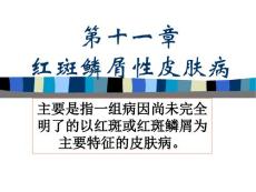 第十一章红斑鳞屑性皮肤病（2）