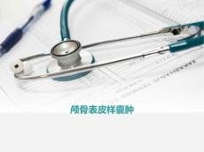 表皮样囊肿分析