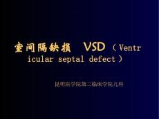 室间隔缺损.ppt
