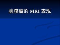 脑膜瘤MRI诊断