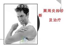 肩周炎课件