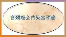 宫颈癌会传染宫颈癌-课件(PPT演示)