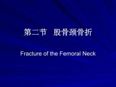《股骨颈骨折》课件
