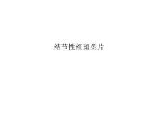 结节性红斑图片课件