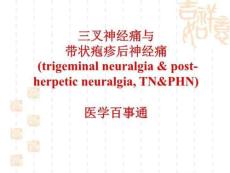 三叉神经痛与带状疱疹后神经痛-课件