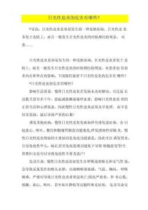 日光性皮炎的危害有哪些
