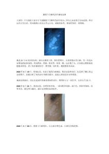 腋窝下白癜风