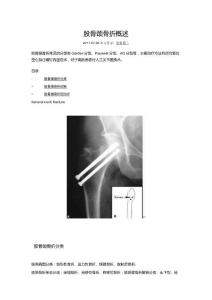股骨颈骨折概述