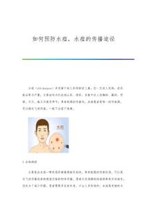 如何预防水痘水痘的传播途径