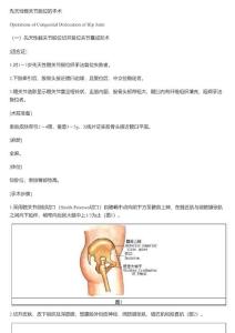 先天性髋关节脱位的手术