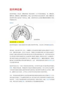 肋间神经痛