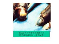 性病图片课件