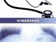 颅内静脉窦血栓形成课件