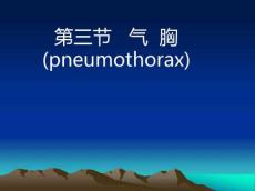 气胸课件