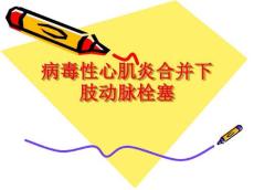 病毒性心肌炎9193