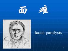 面瘫分析课件