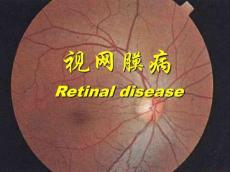 视网膜病图谱资料