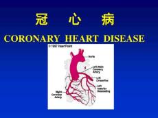 冠心病课件