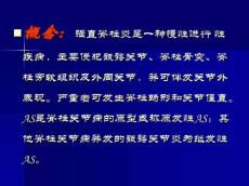 强直性脊柱炎114292