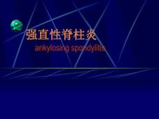 强直性脊柱炎14286