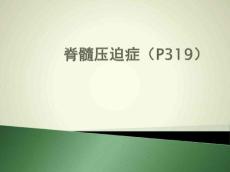 脊髓压迫症