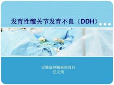 发育性髋关节发育不良11869