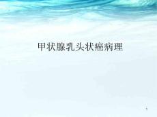 甲状腺乳头状癌PPT课件