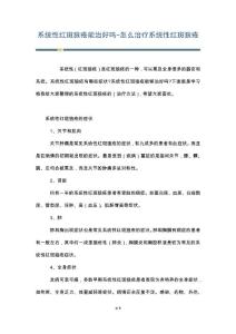 系统性红斑狼疮能治好吗-怎么治疗系统性红斑狼疮