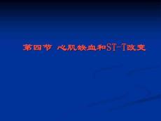 心肌缺血演示文稿