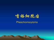 嗜铬细胞瘤