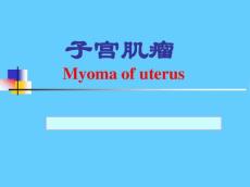 子宫肌瘤10644