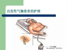 自发性气胸2857
