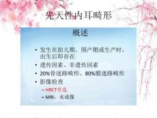 先天性内耳畸形