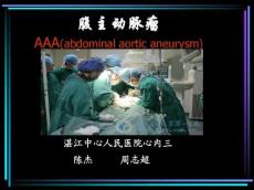 腹主动脉瘤课件